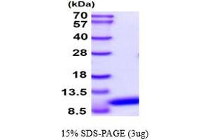 SDS-PAGE (SDS) image for Vesicle-Associated Membrane Protein 3 (VAMP3) (AA 1-77) protein (ABIN667721)