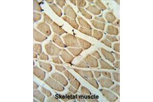 YTHD3 Antibody (Center) IHC analysis in formalin fixed and paraffin embedded skeletal muscle followed by peroxidase conjugation of the secondary antibody and DAB staining. (YTHDF3 antibody  (Middle Region))