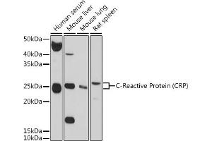 Western Blotting (WB) image for anti-C-Reactive Protein (CRP) (AA 1-224) antibody (ABIN3020716)