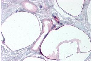Human Breast, Adipocytes (formalin-fixed, paraffin-embedded) stained with FABP4 antibody ABIN790284 at 10 ug/ml followed by biotinylated goat anti-rabbit IgG secondary antibody ABIN481713, alkaline phosphatase-streptavidin and chromogen. (FABP4 antibody  (AA 103-118))