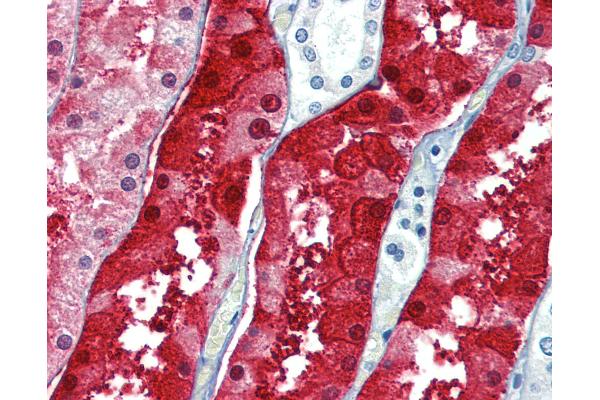 ZFYVE26 antibody  (C-Term)