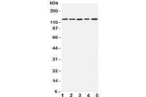 Western blot testing of Integrin alpha 7 antibody and Lane 1:  293T;  2: A431;  3: HeLa;  4: Jurkat;  5: Raji cell lysate. (ITGA7 antibody  (C-Term))