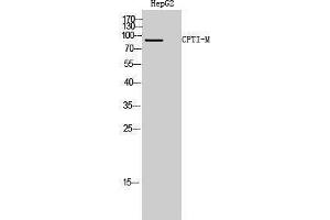 Western Blotting (WB) image for anti-Carnitine Palmitoyltransferase 1B (Muscle) (CPT1B) (Internal Region) antibody (ABIN3174542) (CPT1B antibody  (Internal Region))