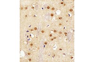 Immunohistochemical analysis of paraffin-embedded M. (BAF53A antibody  (C-Term))
