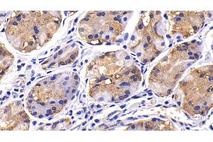 Detection of MMP7 in Human Stomach Tissue using Polyclonal Antibody to Matrix Metalloproteinase 7 (MMP7) (MMP7 antibody  (AA 1-267))