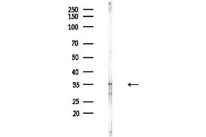 anti-V-Maf Musculoaponeurotic Fibrosarcoma Oncogene Homolog (Avian) (MAF) (C-Term) antibody