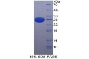 SDS-PAGE (SDS) image for Platelet-Activating Factor Acetylhydrolase 1b, Catalytic Subunit 3 (29kDa) (PAFAH1B3) (AA 28-231) protein (His tag) (ABIN2126333)