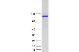 C2CD2-Like (C2CD2L) protein (Myc-DYKDDDDK Tag)