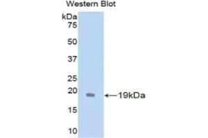 Detection of Recombinant GDNF, Mouse using Polyclonal Antibody to Glial Cell Line Derived Neurotrophic Factor (GDNF) (GDNF antibody  (AA 79-217))