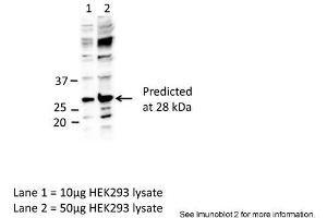Sample Type: Lane1 = 10ug HEK293 lysateLane 2 = 50ug HEK293 lysatePrimary Antibody Dilution: Anti-EIF4E 1:1000Submitted By: Dr. (EIF4E antibody  (C-Term))
