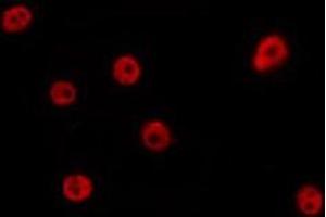 ABIN6275695 staining Hela by IF/ICC. (ZZZ3 antibody  (Internal Region))