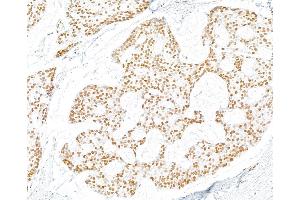 Immunohistochemistry (IHC) image for anti-gamma Histone Variant H2AX (GAMMA-H2AX) (Ser140) antibody (ABIN7454026) (Recombinant gamma H2AX antibody  (Ser140))