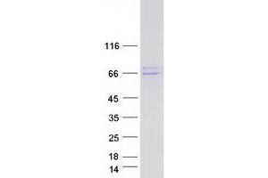 Validation with Western Blot