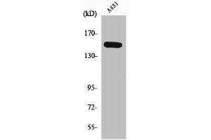 Western Blot analysis of A431 cells using Phospho-PLC β3 (S1105) Polyclonal Antibody