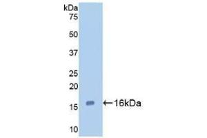 Detection of Recombinant GAL7, Human using Polyclonal Antibody to Galectin 7 (GAL7) (LGALS7 antibody  (AA 1-136))