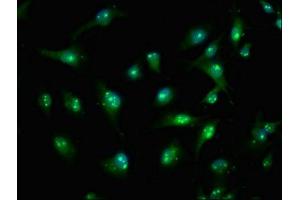 Immunofluorescence staining of U251 cells with ABIN7171462 at 1:100, counter-stained with DAPI. (TIAM2 antibody  (AA 1500-1627))