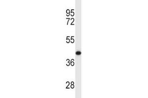 MCL1 antibody western blot analysis in Y79 lysate. (MCL-1 antibody  (AA 217-245))