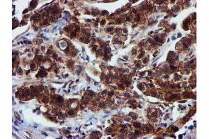 Image no. 8 for anti-Epsin 2 (EPN2) antibody (ABIN1498051) (Epsin 2 antibody)