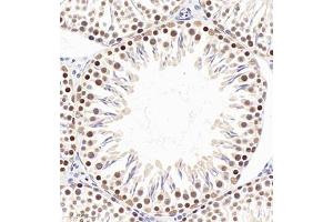Immunohistochemistry of paraffin embedded rat testis using PP4R2 (ABIN7075284) at dilution of 1:2000 (320x lens) (PPP4R2 antibody)