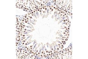 Immunohistochemistry of paraffin embedded rat testis using PP4R2 (ABIN7075284) at dilution of 1:2000 (320x lens)