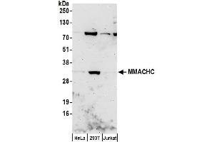 anti-Methylmalonic Aciduria (Cobalamin Deficiency) CblC Type, with Homocystinuria (MMACHC) (AA 175-225) antibody