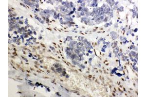 Immunohistochemistry (Paraffin-embedded Sections) (IHC (p)) image for anti-Nuclear Receptor Subfamily 3, Group C, Member 1 (Glucocorticoid Receptor) (NR3C1) (AA 20-199) antibody (ABIN3043371) (Glucocorticoid Receptor antibody  (AA 20-199))