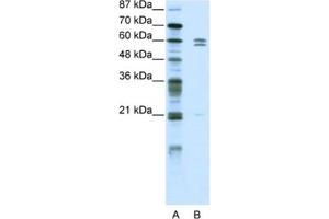 Western Blotting (WB) image for anti-FEZ Family Zinc Finger 2 (FEZF2) antibody (ABIN2461886) (FEZF2 antibody)