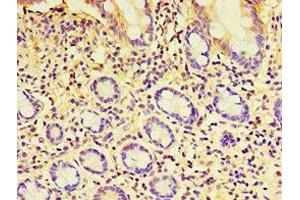 Immunohistochemistry of paraffin-embedded human small intestine tissue using ABIN7152252 at dilution of 1:100 (EXOC2 antibody  (AA 1-220))