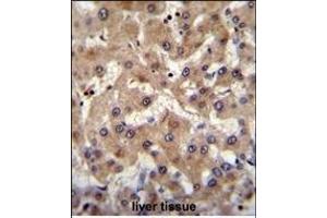 PREF6 Antibody (C-term) (ABIN655365 and ABIN2844922) immunohistochemistry analysis in formalin fixed and paraffin embedded human liver tissue followed by peroxidase conjugation of the secondary antibody and DAB staining. (PRAMEF6 antibody  (C-Term))