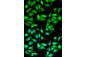 Immunofluorescence analysis of HeLa cell using GSS antibody. (Glutathione Synthetase antibody  (AA 1-474))