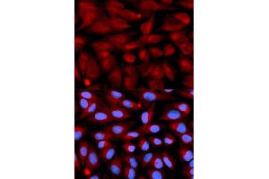 Immunofluorescence analysis of U2OS cells using CD70 antibody (ABIN5971064). (CD70 antibody)