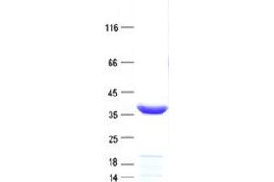 Validation with Western Blot (NSMCE2 Protein (His tag))