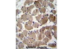 COCH Antibody (Center) immunohistochemistry analysis in formalin fixed and paraffin embedded human skeletal muscle followed by peroxidase conjugation of the secondary antibody and DAB staining. (COCH antibody  (Middle Region))