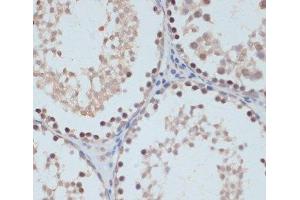 Immunohistochemistry (Paraffin-embedded Sections) (IHC (p)) image for anti-Signal Transducer and Activator of Transcription 1, 91kDa (STAT1) (pSer727) antibody (ABIN7265092)