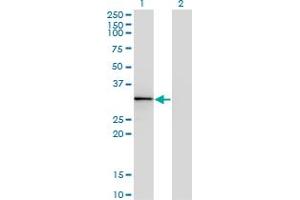 Western Blot analysis of HOXB1 expression in transfected 293T cell line by HOXB1 monoclonal antibody (M06), clone 2F12. (HOXB1 antibody  (AA 101-210))