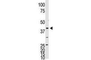 Image no. 1 for anti-Neuronal Differentiation 1 (NEUROD1) (C-Term) antibody (ABIN357406)