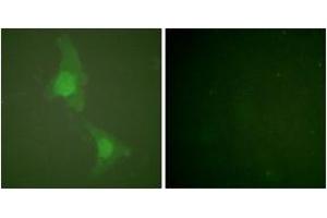 Immunofluorescence analysis of HeLa cells, using ADD1 (Ab-726) Antibody. (alpha Adducin antibody  (AA 688-737))