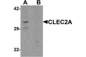 Western blot analysis of CLEC2A in K562 cell lysate with CLEC2A Antibody  at 1 ug/ml in (A) the absence and (B) the presence of blocking peptide.