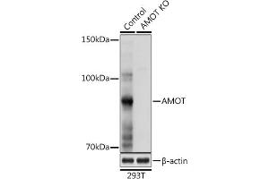 Western blot analysis of extracts from normal (control) and AMOT Rabbit pAb knockout (KO) 293T cells, using AMOT Rabbit pAb antibody (ABIN6128973, ABIN6136838, ABIN6136839 and ABIN6224101) at 1:1000 dilution. (Angiomotin antibody  (AA 1-300))