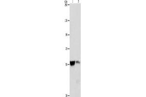 Gel: 8 % SDS-PAGE, Lysate: 40 μg, Lane 1-2: Mouse liver tissue, Mouse kidney tissue, Primary antibody: ABIN7128351(ALDH8A1 Antibody) at dilution 1/550, Secondary antibody: Goat anti rabbit IgG at 1/8000 dilution, Exposure time: 3 seconds (ALDH8A1 antibody)