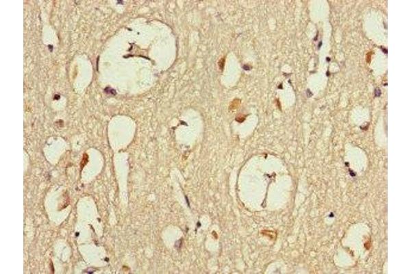 Dmx-Like 2 antibody  (AA 2471-2657)