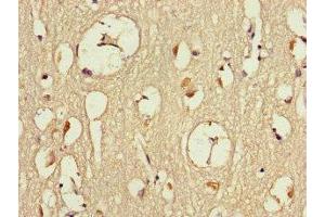 Immunohistochemistry of paraffin-embedded human brain tissue using ABIN7150100 at dilution of 1:100 (Dmx-Like 2 antibody  (AA 2471-2657))