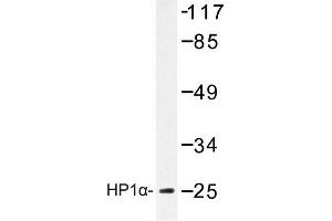 Image no. 1 for anti-Chromobox Homolog 5 (CBX5) antibody (ABIN272193) (CBX5 antibody)