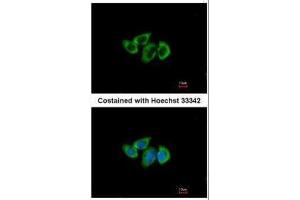 ICC/IF Image Immunofluorescence analysis of methanol-fixed A549, using RPL3, antibody at 1:500 dilution. (RPL3 antibody)
