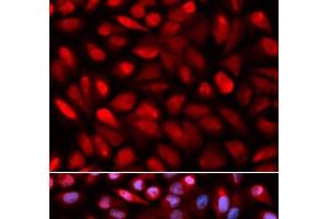 Immunofluorescence analysis of U2OS cells using PCBP2 Polyclonal Antibody (PCBP2 antibody)