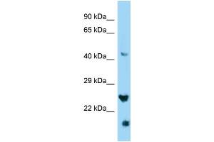 WB Suggested Anti-IZUMO4 Antibody Titration: 1.