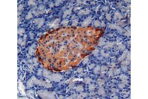 Used in DAB staining on fromalin fixed paraffin- embedded pancreas tissue (Cardiotrophin 1 antibody  (AA 1-203))