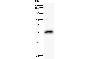 Western Blotting (WB) image for anti-Small Nuclear RNA Activating Complex, Polypeptide 4, 190kDa (SNAPC4) antibody (ABIN930927)