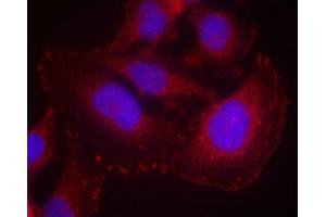Immunofluorescence staining of methanol-fixed Hela cells using PLC-g1(phospho-Tyr771) Antibody. (Phospholipase C gamma 1 antibody  (pTyr771))