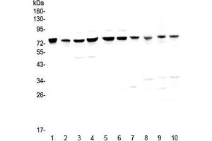 Western blot testing of human 1) HeLa, 2) placenta, 3) COLO-320, 4) HepG2, 5) PANC-1, 6) SGC-7901, 7) MBA-MD-231, 8) rat kidney, 9) mouse heart and 10) mouse kidney with PARN antibody at 0.